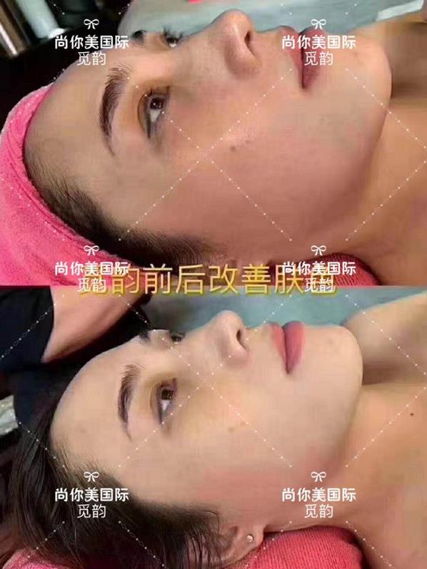 美白面膜哪個(gè)牌子的效果好價(jià)格便宜點(diǎn)