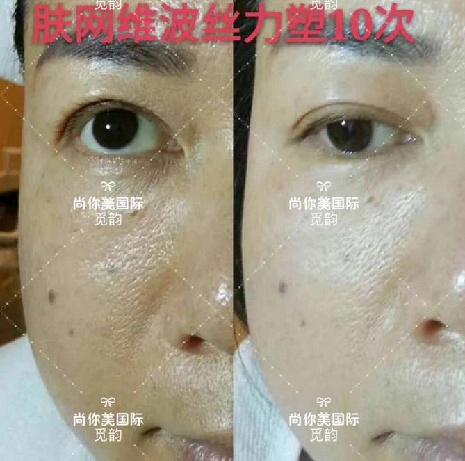美白面膜哪個(gè)牌子的效果好價(jià)格便宜點(diǎn)