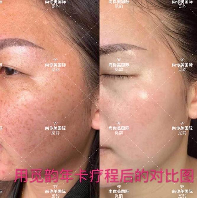 美白面膜哪個(gè)牌子的效果好價(jià)格便宜點(diǎn)