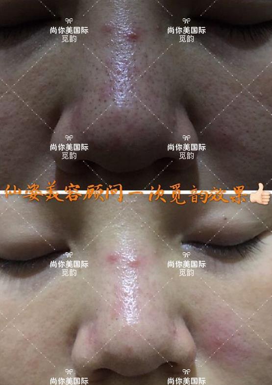 美白面膜哪個(gè)牌子的效果好價(jià)格便宜點(diǎn)