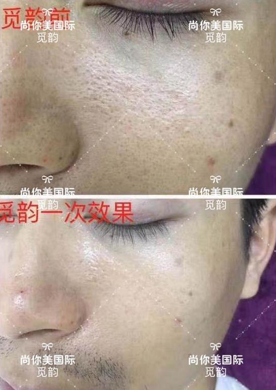 美白面膜哪個(gè)牌子的效果好價(jià)格便宜點(diǎn)