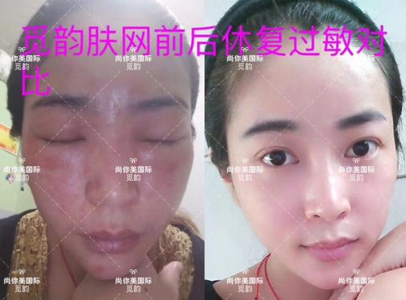 美白面膜哪個(gè)牌子的效果好價(jià)格便宜點(diǎn)