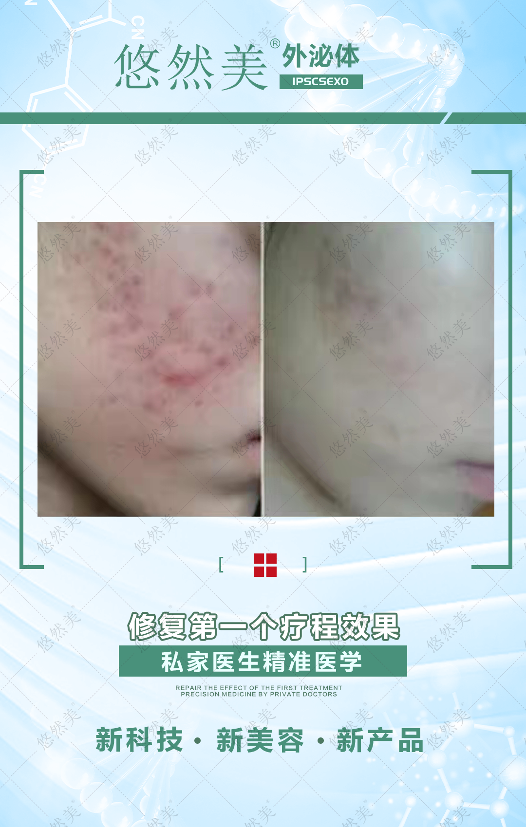 外泌體有什么功效與作用，正規(guī)嗎   來(lái)看一下部分案例