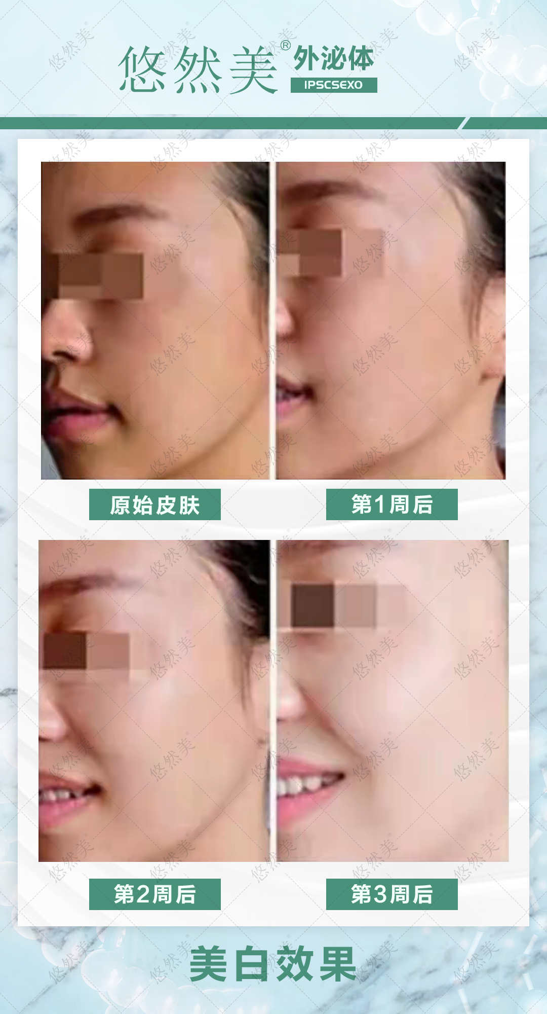 外泌體有什么功效與作用，正規(guī)嗎   來(lái)看一下部分案例