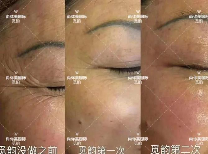 美容院拓客套盒方法，眼部面部身體拓客套盒話術(shù)