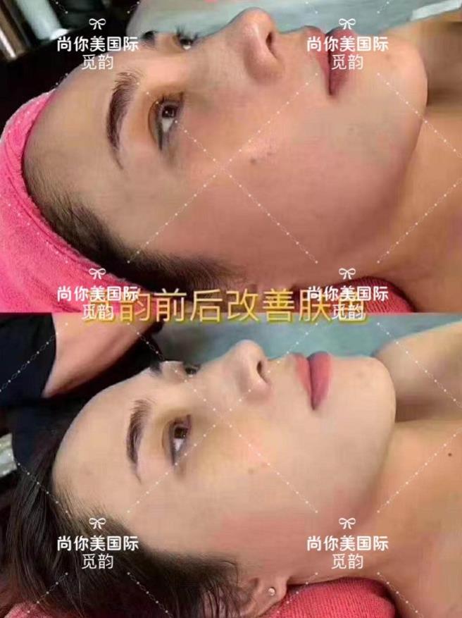 美容院拓客套盒方法，眼部面部身體拓客套盒話術(shù)