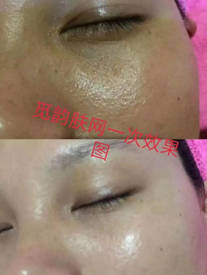 美容院美容產(chǎn)品加盟項目覓韻