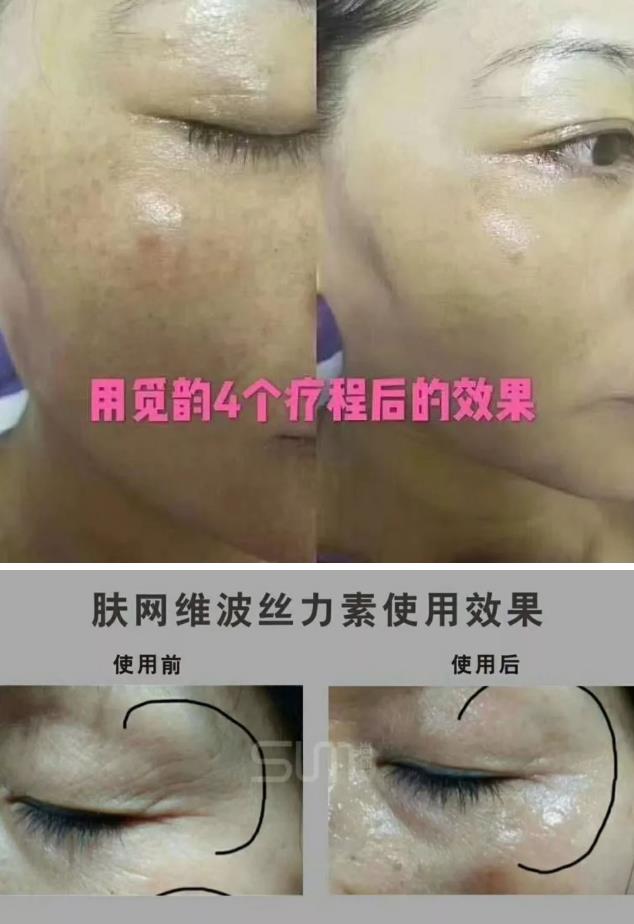 美容院美容產(chǎn)品加盟項目覓韻