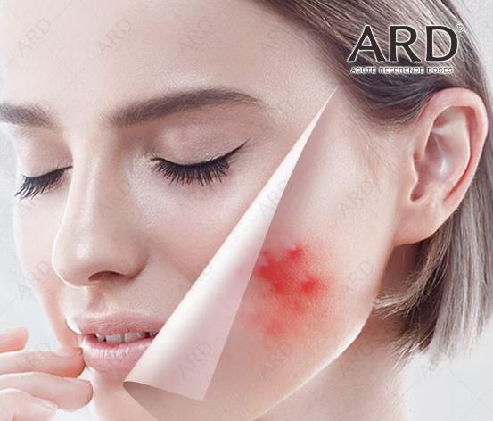 【科肌膚】ARD炎性膚質(zhì) + 精準(zhǔn)特護