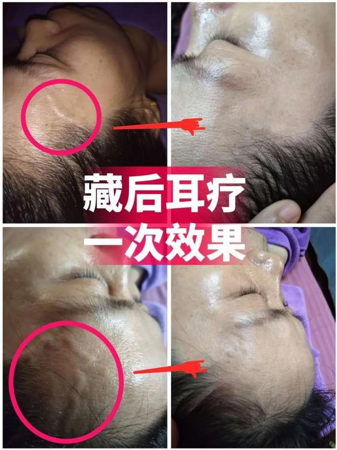 尤其適宜虛寒癥和痛癥、痹癥的人群